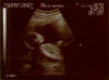 In the beginning...
